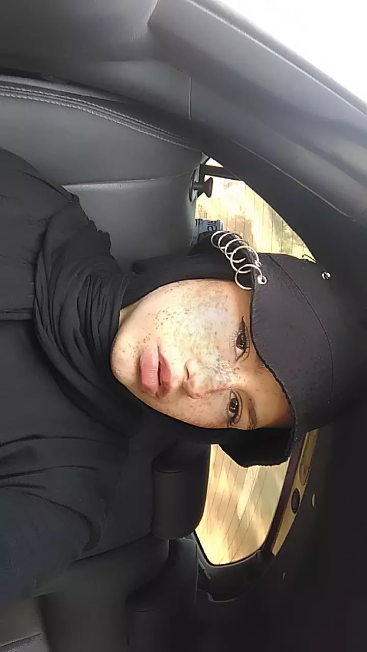Rana keskin