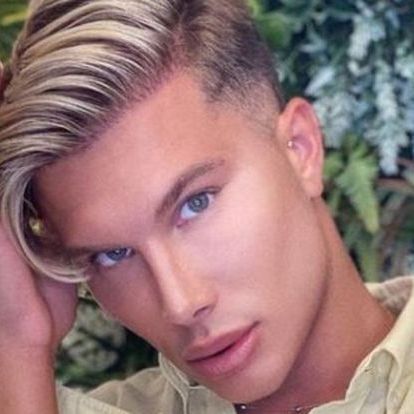 Berra